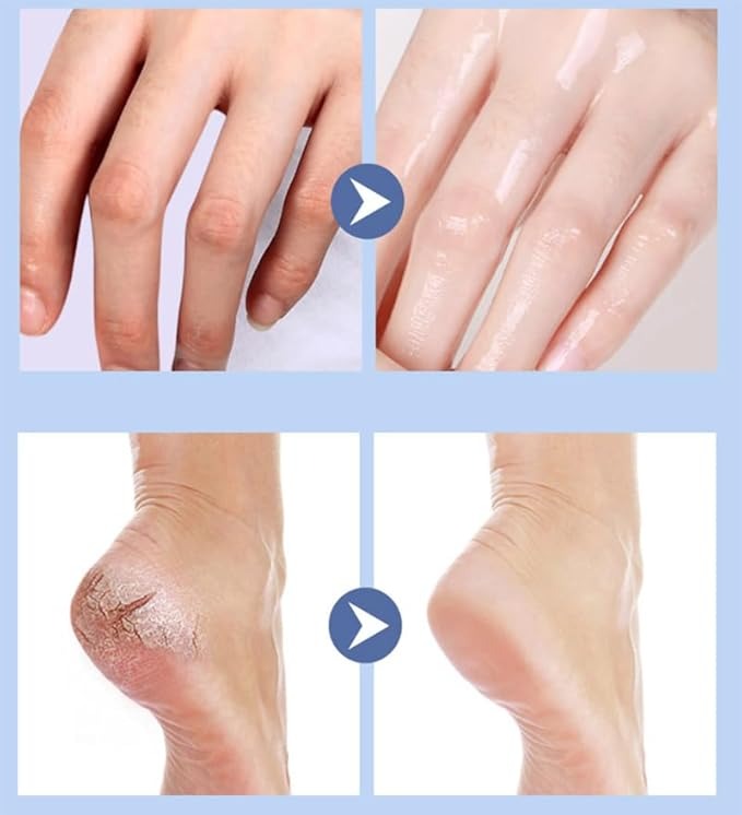 Foot Protective Cream