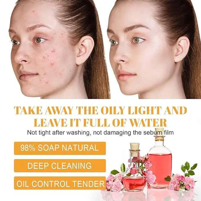 Turmeric Kojic Acid Facial Cleanser