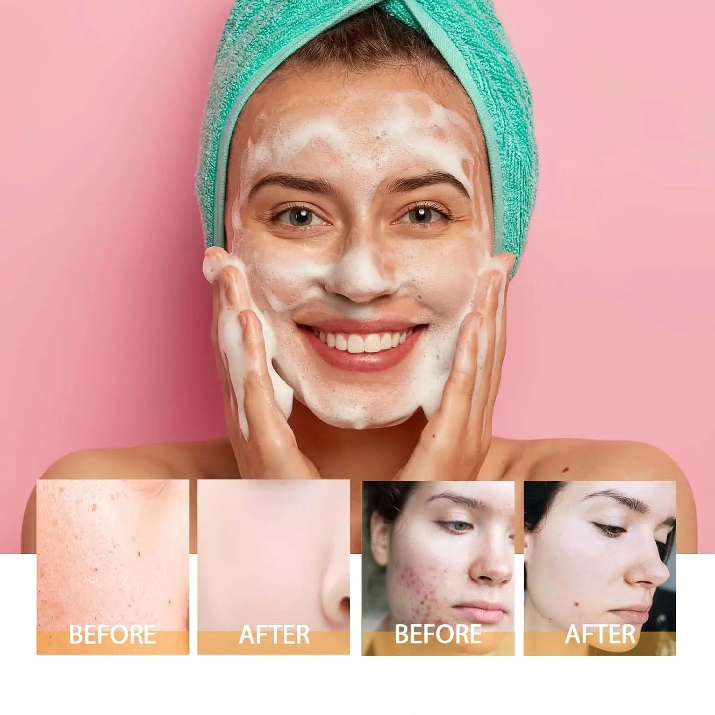 Turmeric Kojic Acid Facial Cleanser
