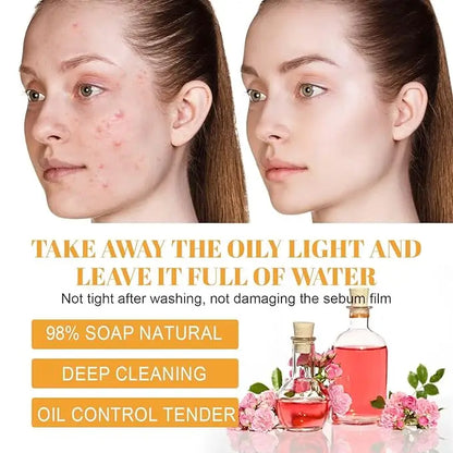 Turmeric Kojic Acid Facial Cleanser