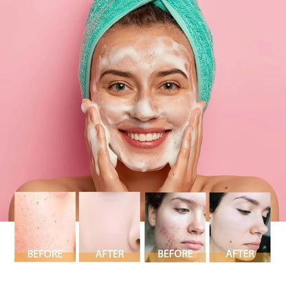 Turmeric Kojic Acid Facial Cleanser