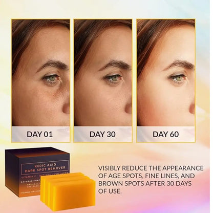 Turmeric and Kojic Soap